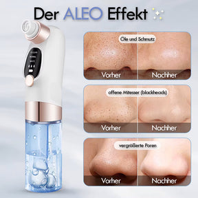 ALEO Multi Porenreiniger